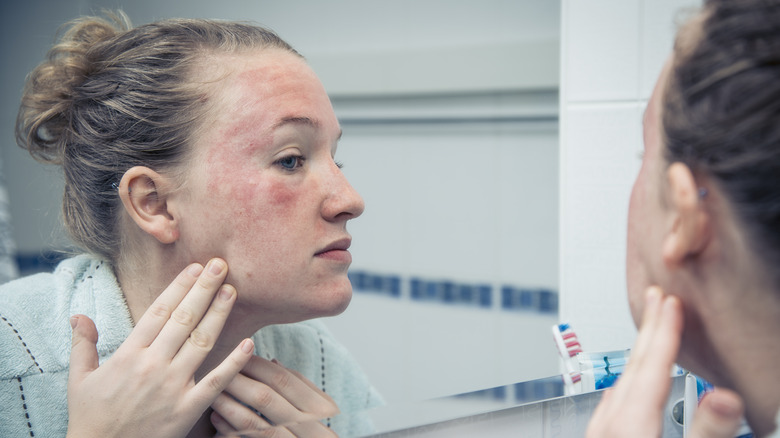 Sensitive skin reaction